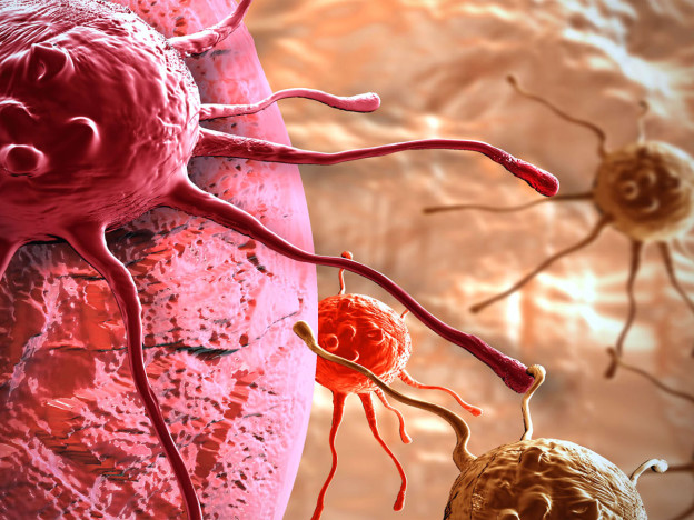 Tumore E Cancro Sono La Stessa Cosa