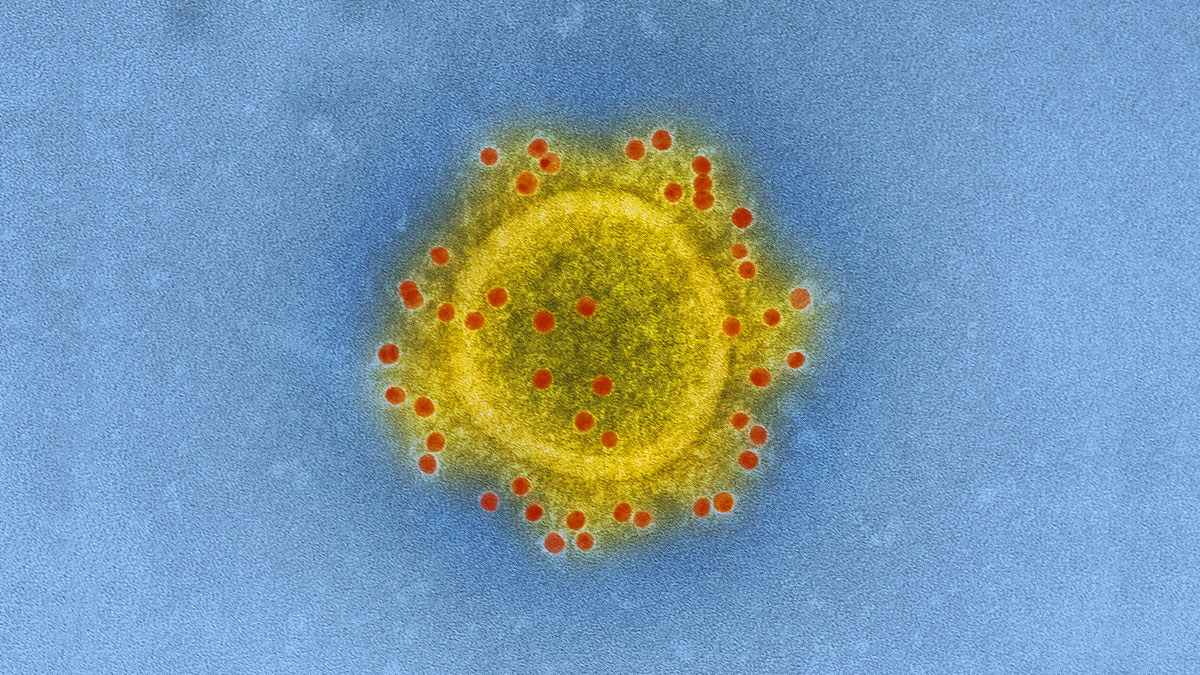 coronavirus: SARS-CoV-2 al microscopio. Il virus responsabile della malattia COVID-19